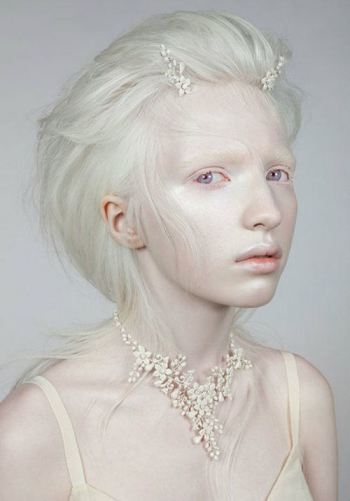 Albino Person