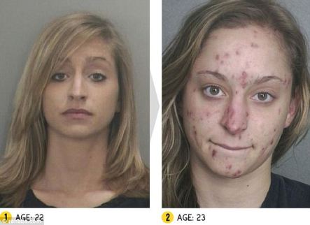 Meth Before And After