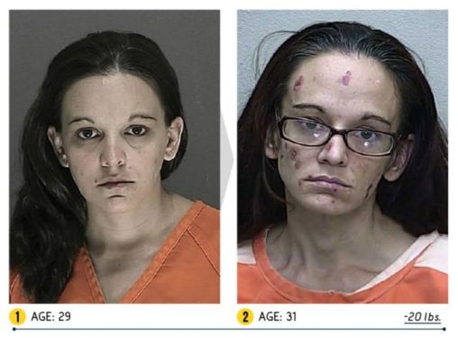 Meth Faces Before And After