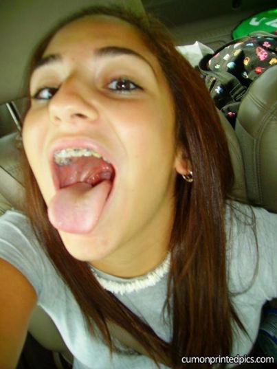Open Mouth Braces Cum Facial