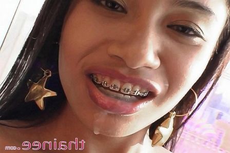 Teen Facial With Braces