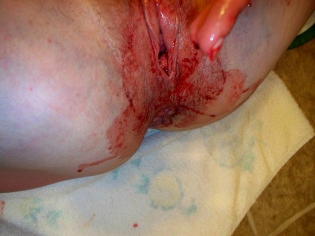 Virgin Pussy Bleeding On Period