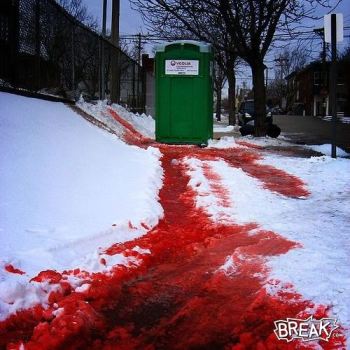 What Does It Look Like To Have A Period