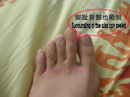 Angel Foot
