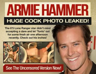 Armie Hammer Gay Nude