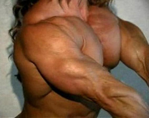Colette Guimond Pecs