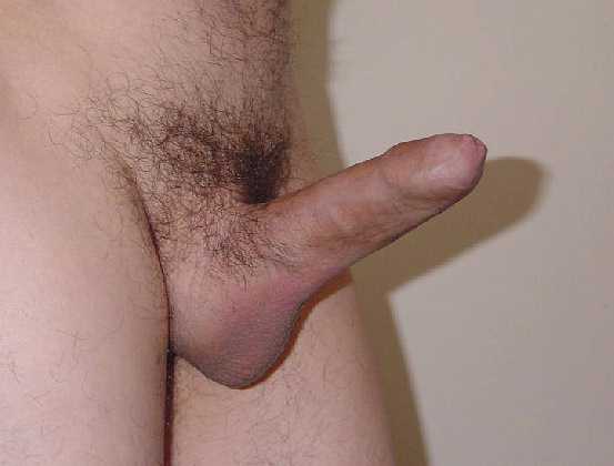 Erect Penis With Phimosis
