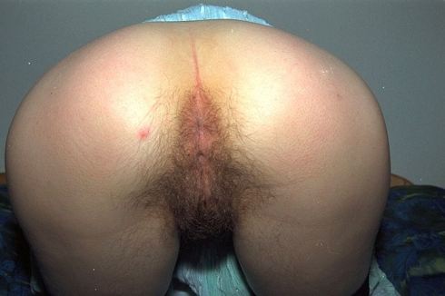 Hairy Pussy And Asshole Spread