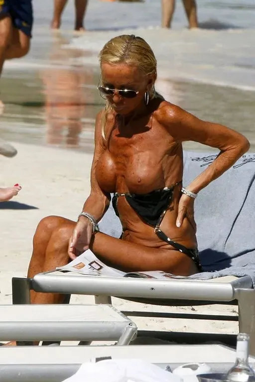 donatella versace breast implants